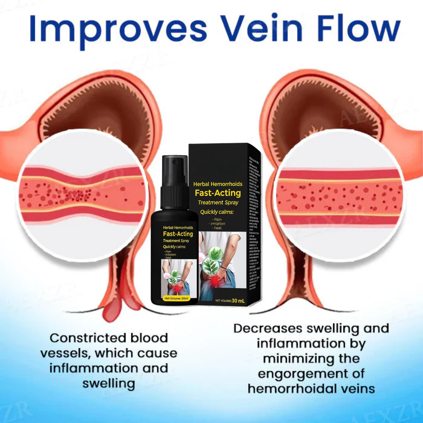 🔥hot sale 50% off🔥🌿herbal hemorrhoids fast-acting treatment spray - 7 days to a happy , pain-free 🔥 buy 1 get 1 free! 🔥