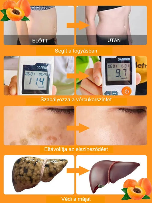 High Yielding, Easy-to-Vitalize Apricot Tree Seeds ??BUY 1 GET 1 FREE! ?